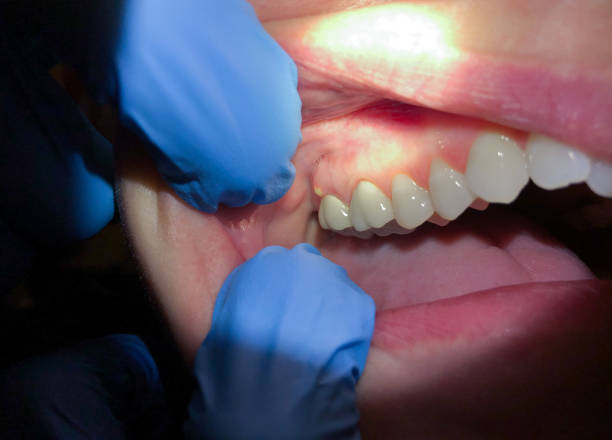 Best Weekend Emergency Dentist in Auburn, GA