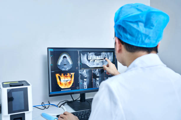 Best Emergency Wisdom Teeth Removal in Auburn, GA